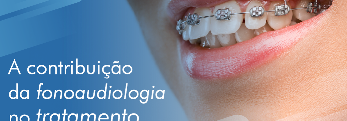 a-contribuicao-da-fonoaudiologia-no-tratamento-ortodontico